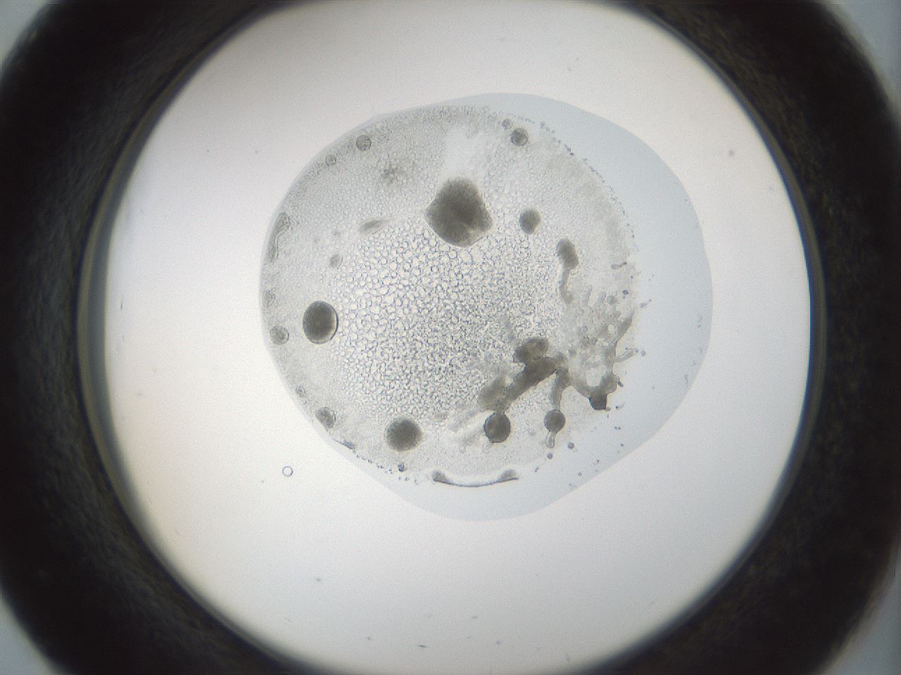 folderID987_plateID987_batchID1639_wellNum51_profileID1_d2_r40415_ef.jpg