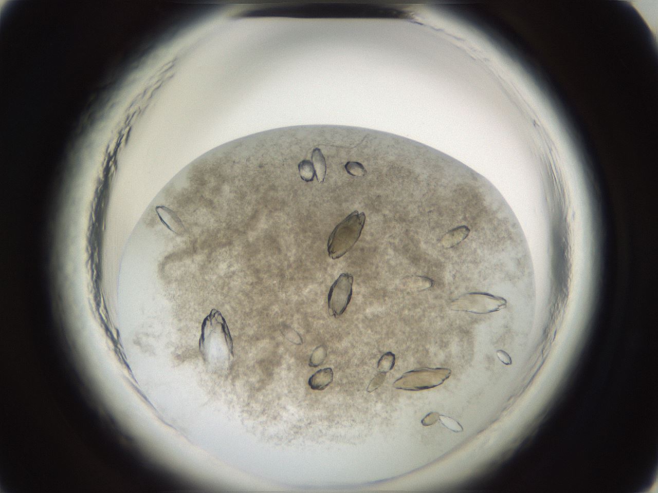 folderID696_plateID1696_batchID7006_wellNum2_profileID1_d1_r112561_ef.jpg