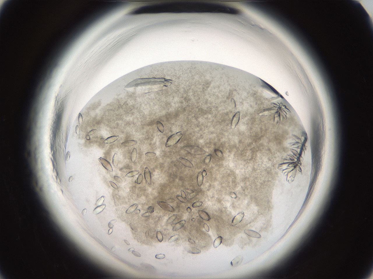 folderID696_plateID1696_batchID7031_wellNum6_profileID1_d1_r112569_ef.jpg