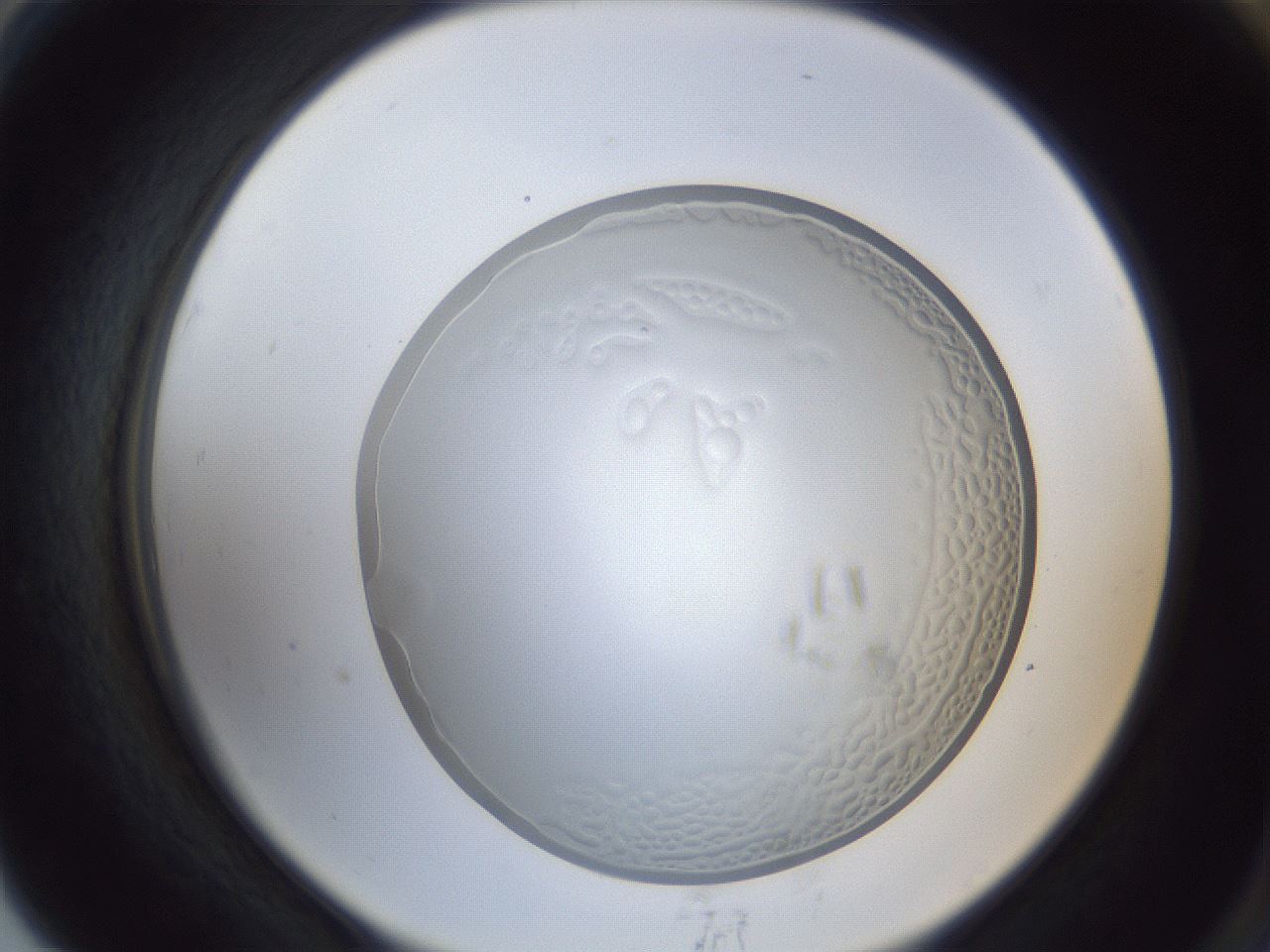 folderID165_plateID1165_batchID2958_wellNum79_profileID1_d2_r61244_ef.jpg