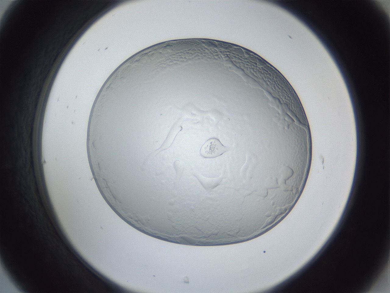 folderID205_plateID1205_batchID3392_wellNum31_profileID1_d2_r66813_ef.jpg