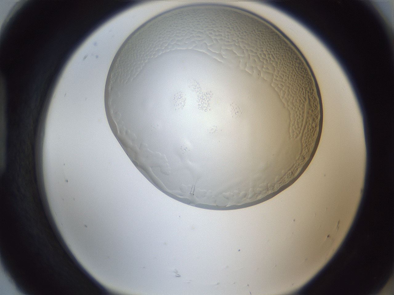 folderID205_plateID1205_batchID3606_wellNum92_profileID1_d1_r66934_ef.jpg