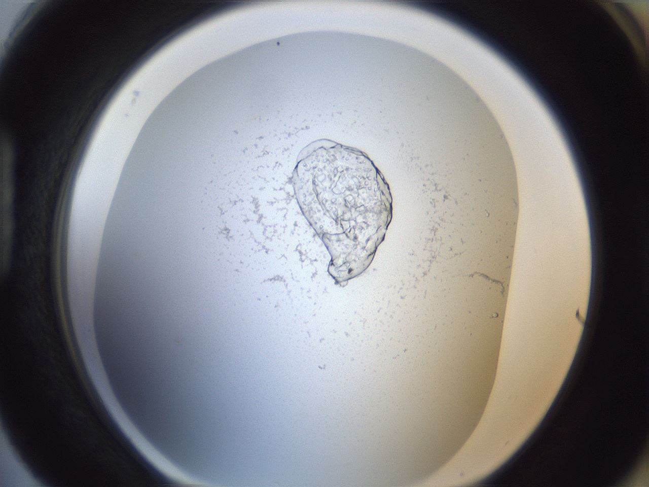 folderID217_plateID1217_batchID3527_wellNum88_profileID1_d1_r68942_ef.jpg