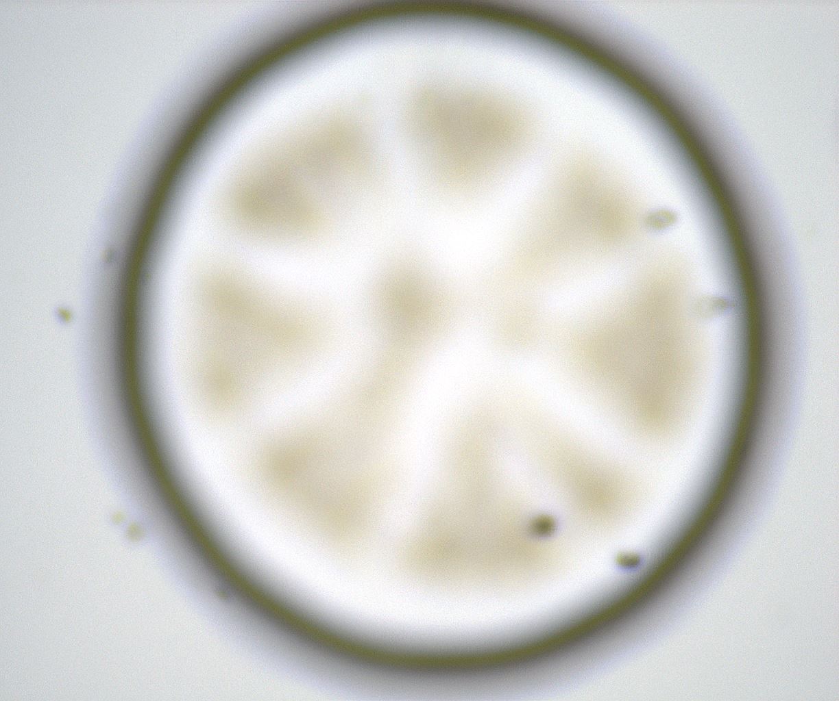 folderID37_plateID2037_batchID9029_wellNum96_profileID1_d1_r137004_ef.jpg