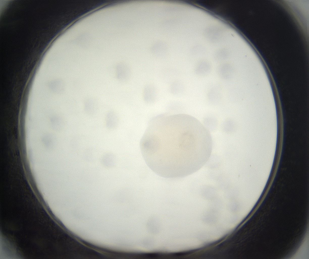 folderID381_plateID3381_batchID20593_wellNum64_profileID1_d1_r299250_ef.jpg