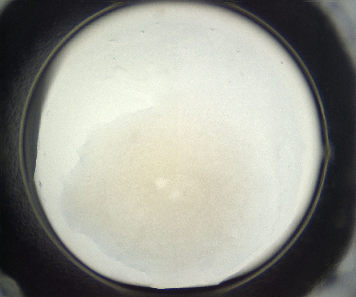 folderID381_plateID3381_batchID21719_wellNum60_profileID1_d1_r299246_ef.jpg