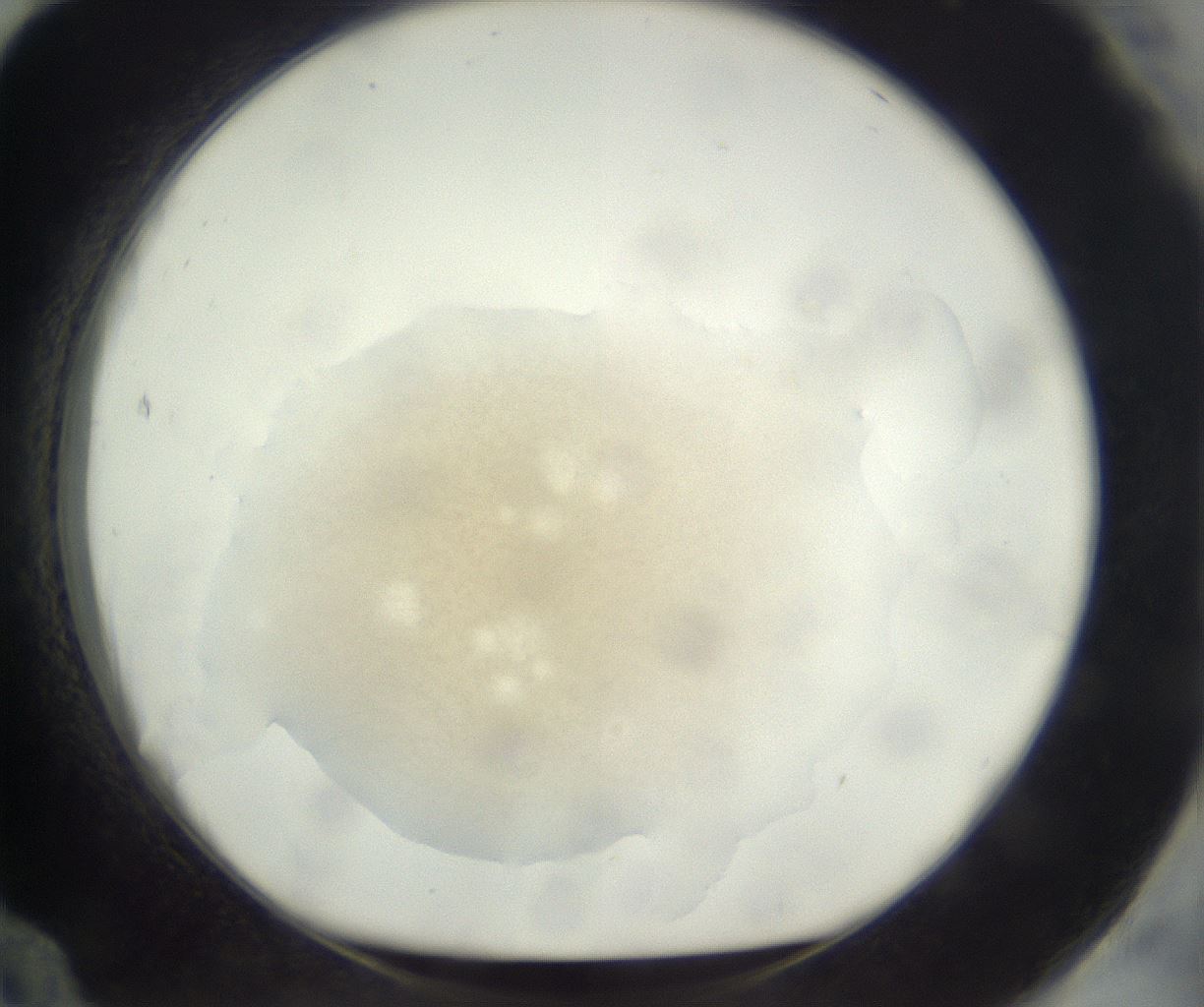 folderID381_plateID3381_batchID21719_wellNum84_profileID1_d1_r299270_ef.jpg
