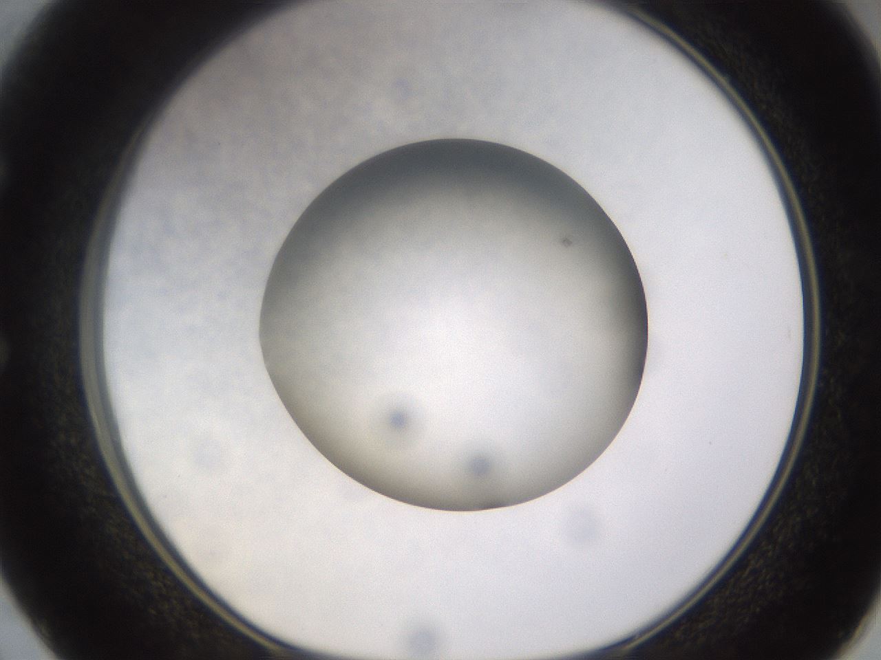 folderID395_plateID1395_batchID4998_wellNum50_profileID1_d1_r85699_ef.jpg