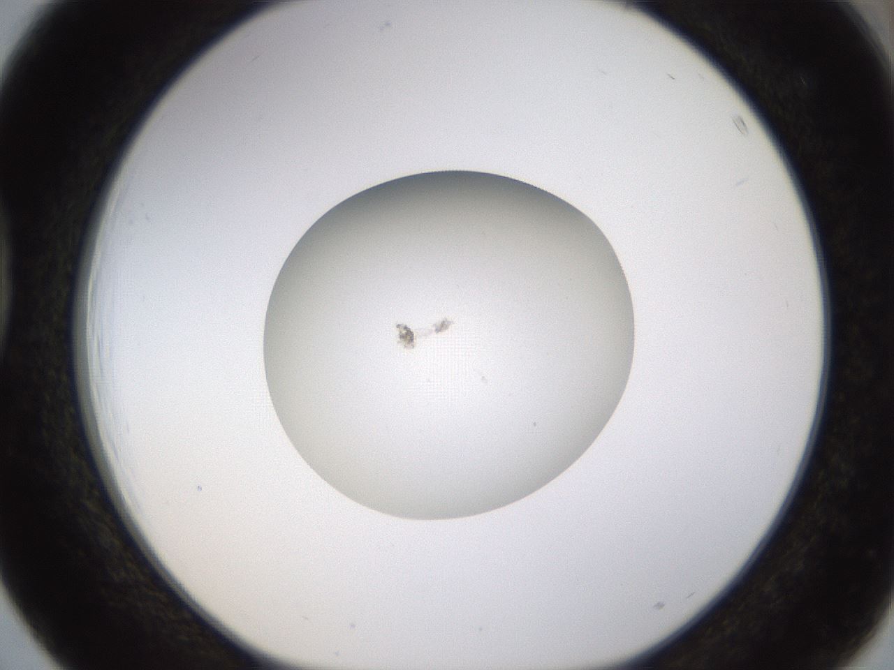 folderID400_plateID1400_batchID5159_wellNum39_profileID1_d1_r85592_ef.jpg