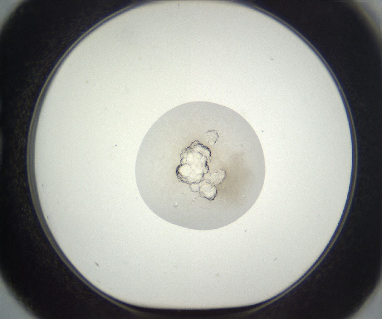 folderID398_plateID3398_batchID19849_wellNum75_profileID1_d1_r301757_ef.jpg