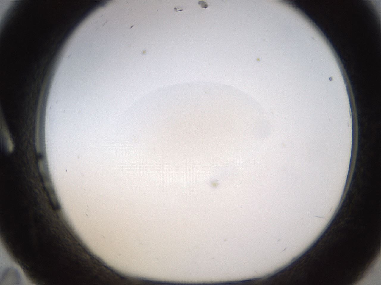 folderID401_plateID1401_batchID5152_wellNum11_profileID1_d1_r84988_ef.jpg