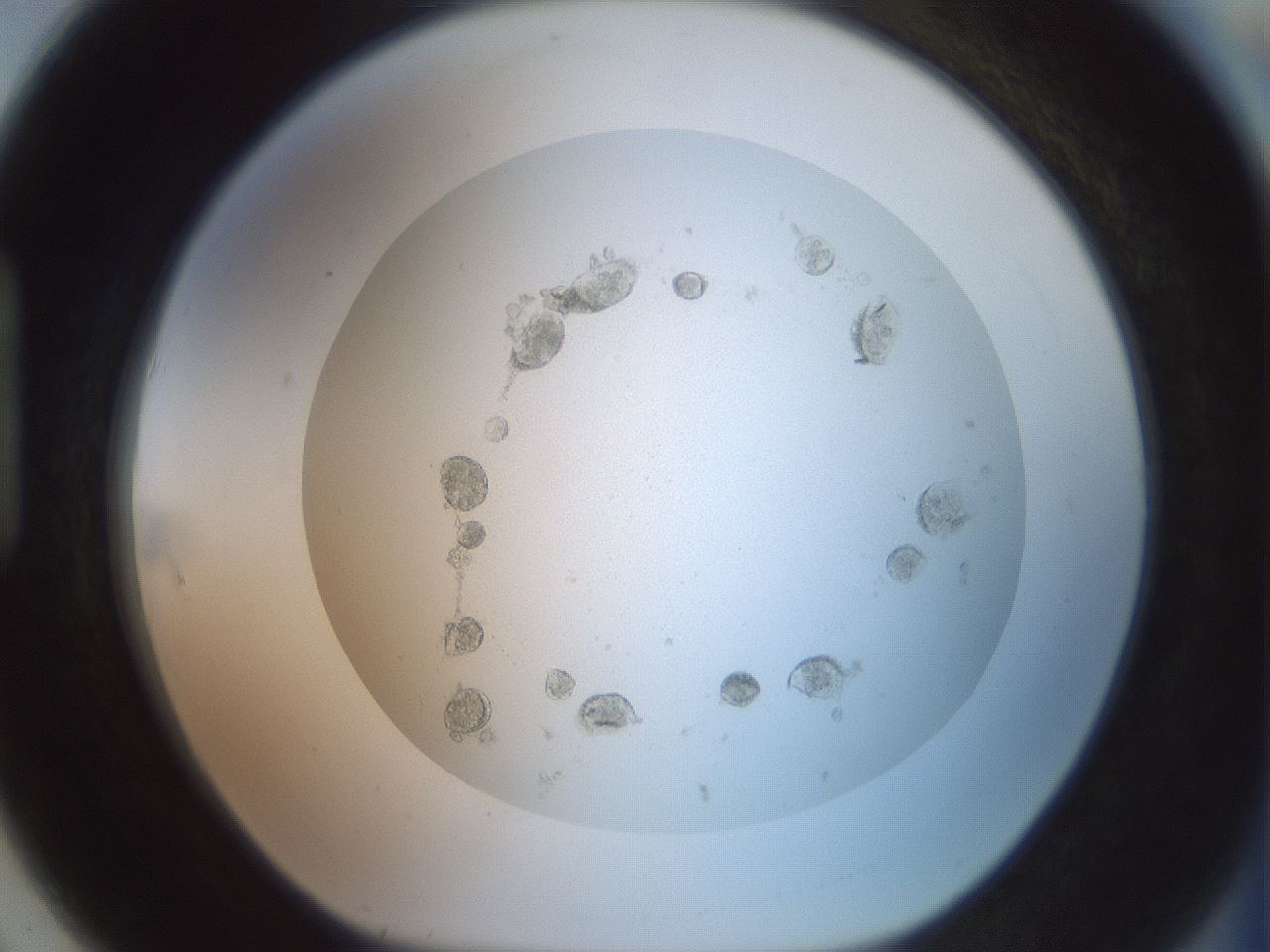 folderID402_plateID2402_batchID11410_wellNum91_profileID1_d1_r177943_ef.jpg
