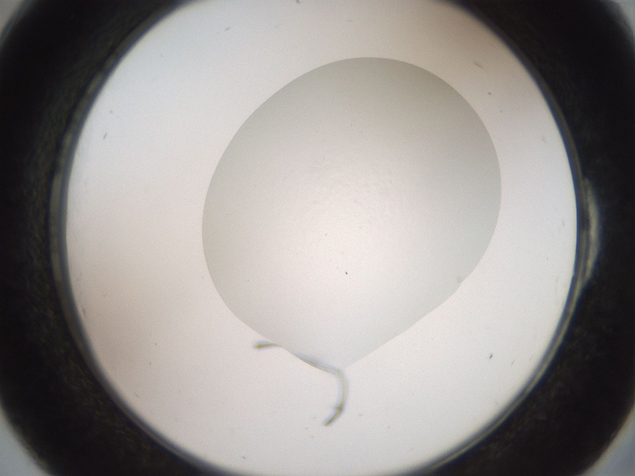 folderID418_plateID3418_batchID19971_wellNum54_profileID1_d2_r303343_ef.jpg