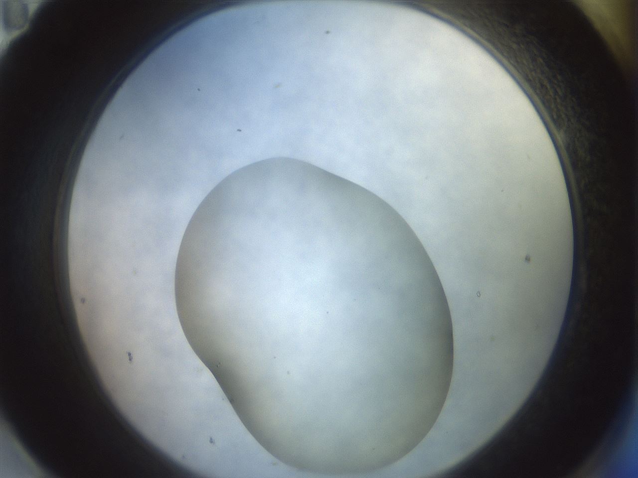 folderID432_plateID3432_batchID19970_wellNum95_profileID1_d2_r305253_ef.jpg