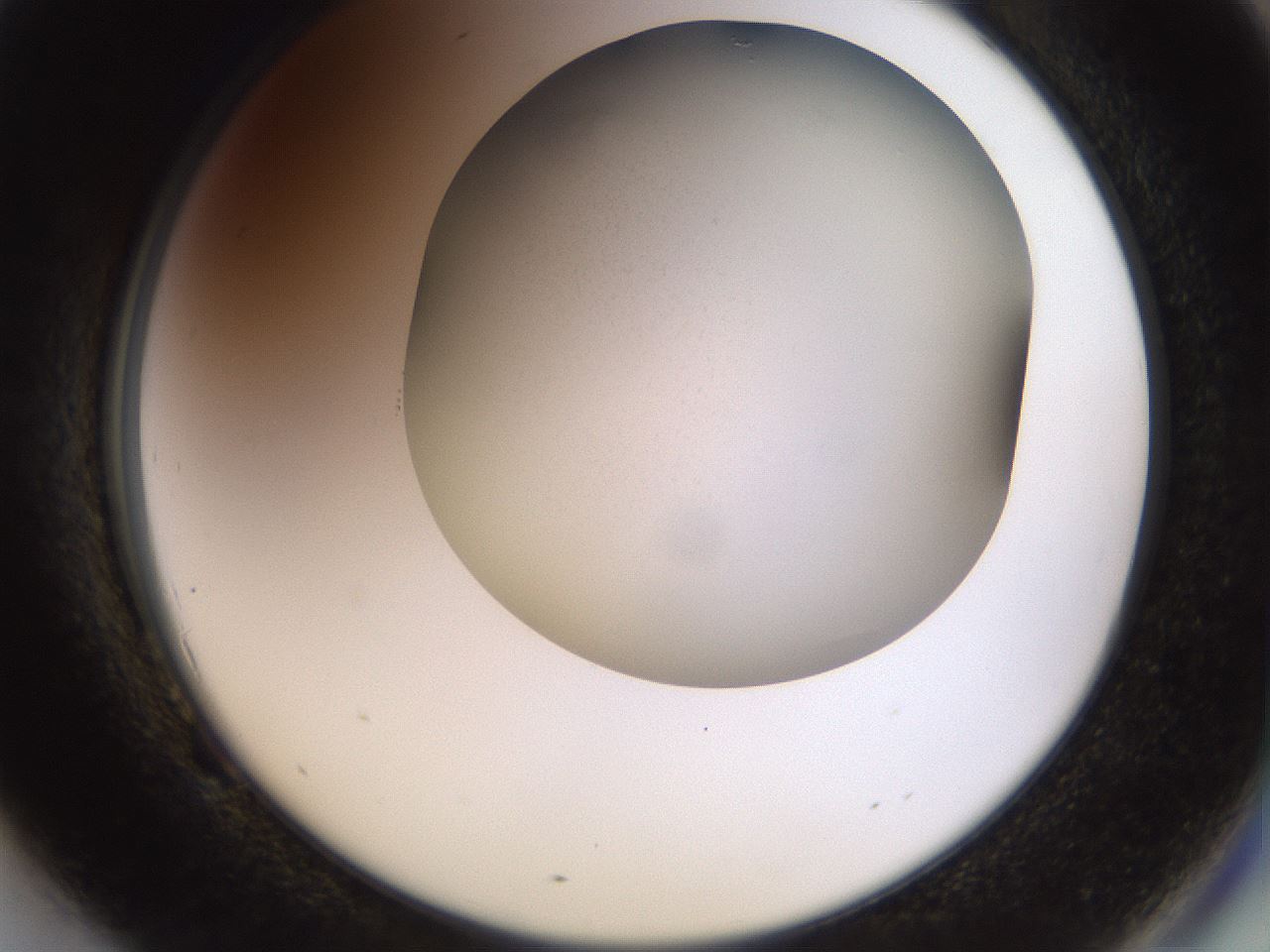 folderID515_plateID1515_batchID5881_wellNum69_profileID1_d2_r96538_ef.jpg