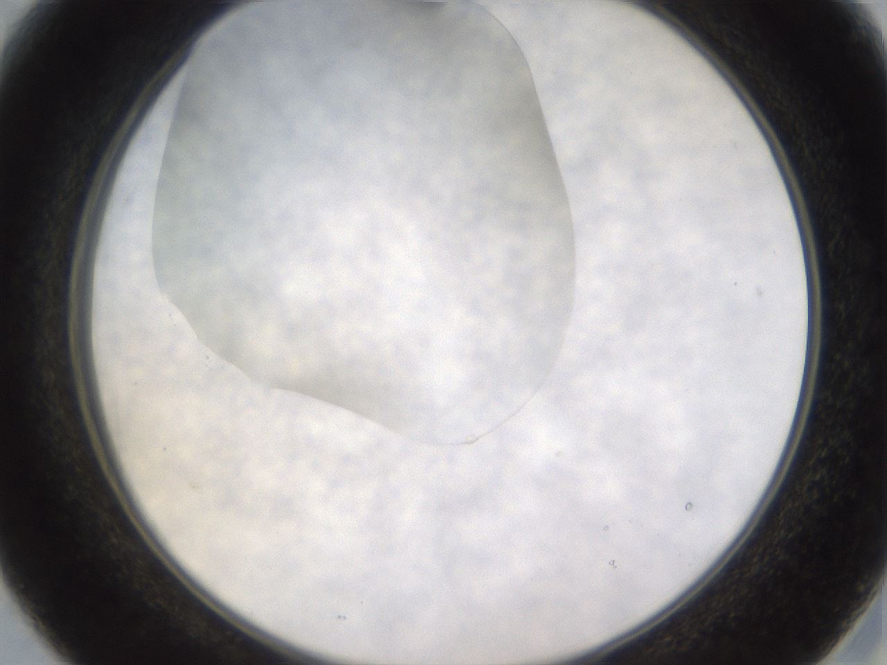 folderID520_plateID1520_batchID5884_wellNum15_profileID1_d2_r97390_ef.jpg