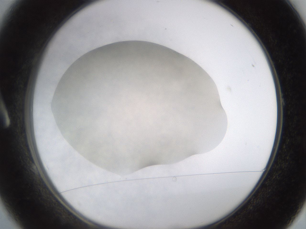 folderID521_plateID1521_batchID5885_wellNum1_profileID1_d1_r97553_ef.jpg