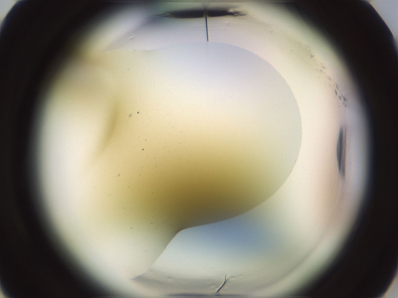 folderID577_plateID2577_batchID14304_wellNum5_profileID1_d3_r198455_ef.jpg