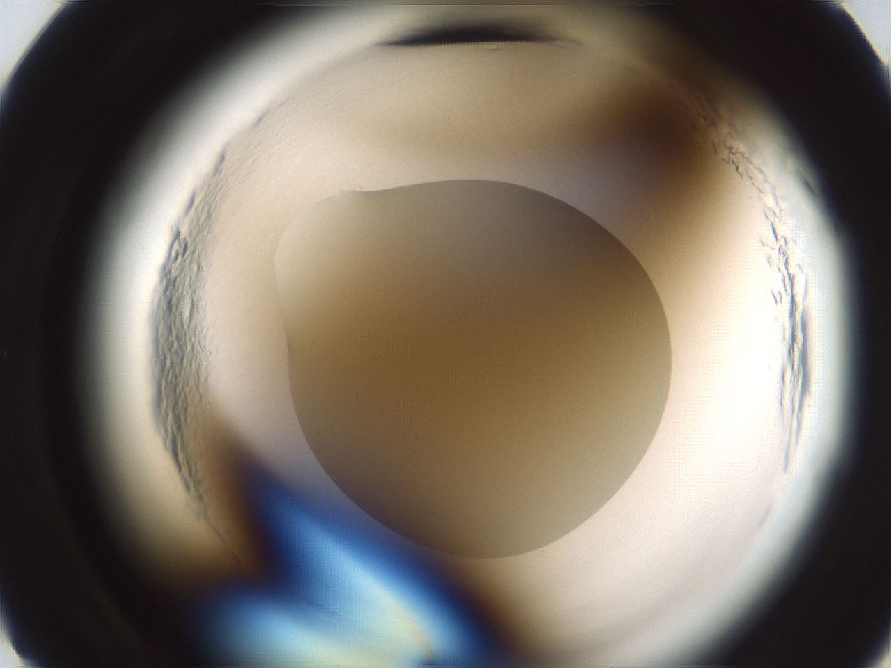 folderID580_plateID2580_batchID12838_wellNum11_profileID1_d2_r200776_ef.jpg