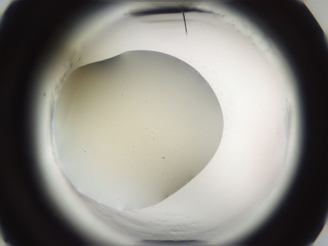 folderID587_plateID2587_batchID12833_wellNum4_profileID1_d3_r197876_ef.jpg