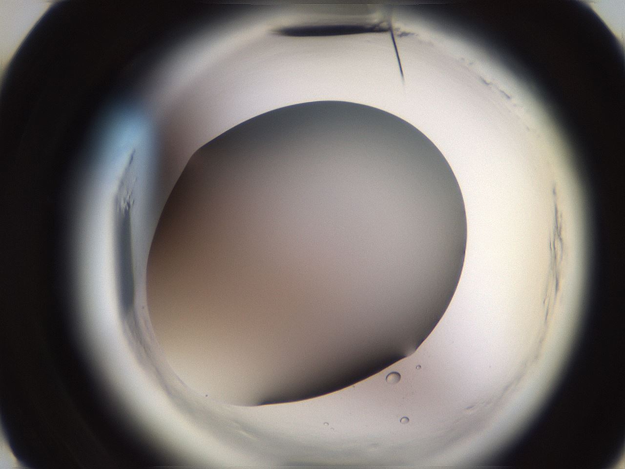folderID589_plateID2589_batchID12885_wellNum10_profileID1_d3_r200198_ef.jpg