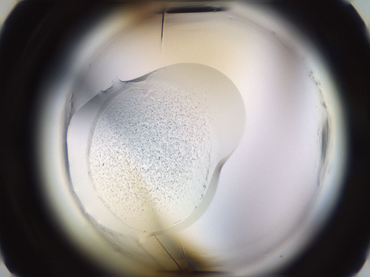 folderID589_plateID2589_batchID14834_wellNum5_profileID1_d2_r200182_ef.jpg