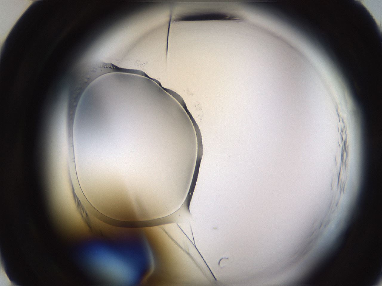 folderID590_plateID2590_batchID15101_wellNum10_profileID1_d2_r201061_ef.jpg