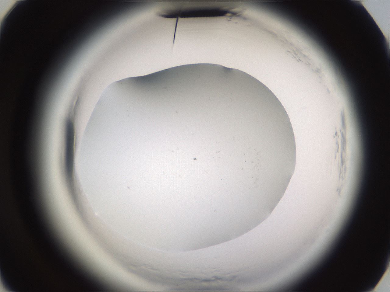folderID594_plateID2594_batchID12796_wellNum39_profileID1_d3_r205470_ef.jpg