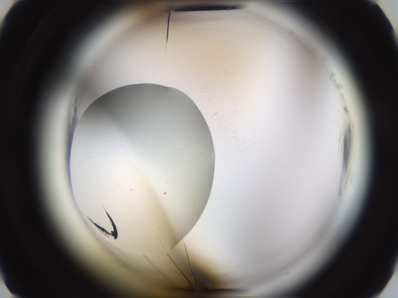 folderID596_plateID2596_batchID12905_wellNum5_profileID1_d2_r206807_ef.jpg