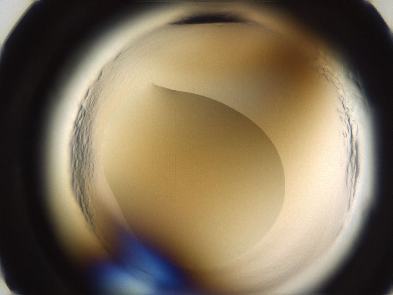 folderID596_plateID2596_batchID15122_wellNum11_profileID1_d2_r206825_ef.jpg