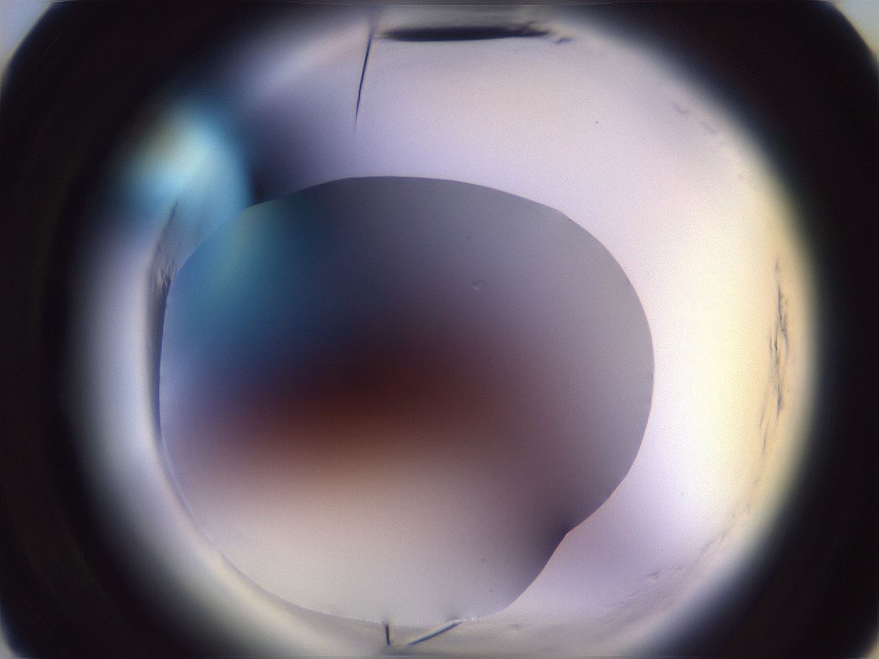 folderID607_plateID2607_batchID12784_wellNum10_profileID1_d3_r204519_ef.jpg