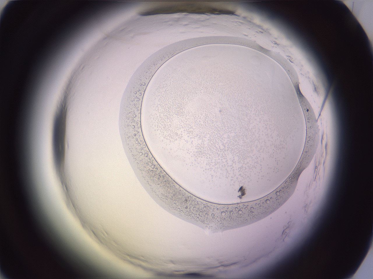 folderID605_plateID2605_batchID12974_wellNum25_profileID1_d1_r202834_ef.jpg