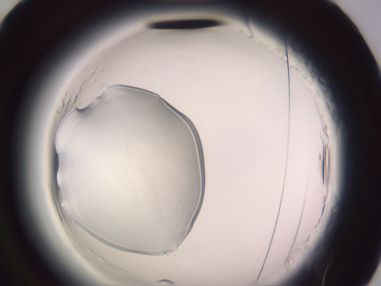 folderID640_plateID2640_batchID14561_wellNum94_profileID1_d2_r214759_ef.jpg