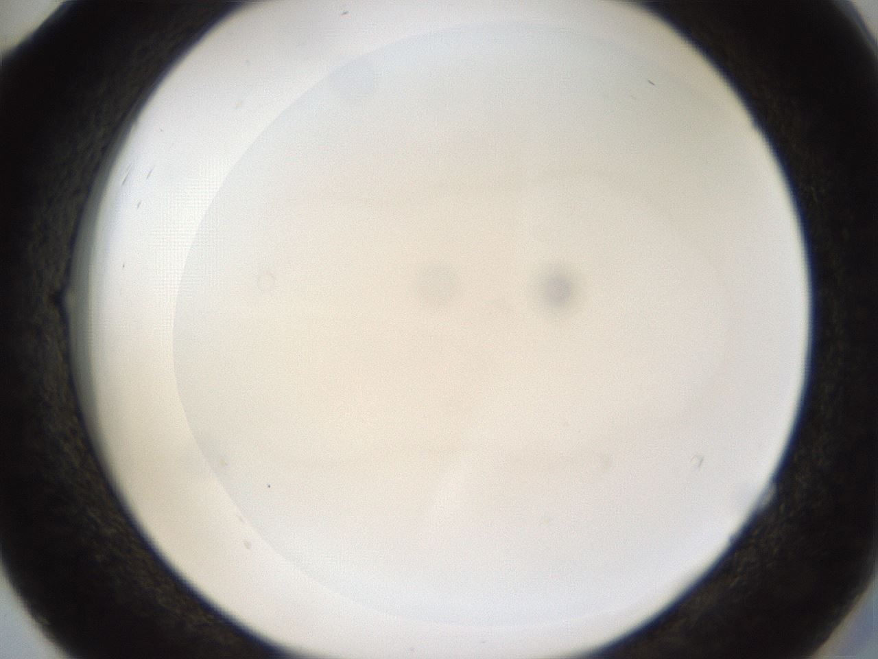 folderID80_plateID1080_batchID3167_wellNum52_profileID1_d2_r52316_ef.jpg