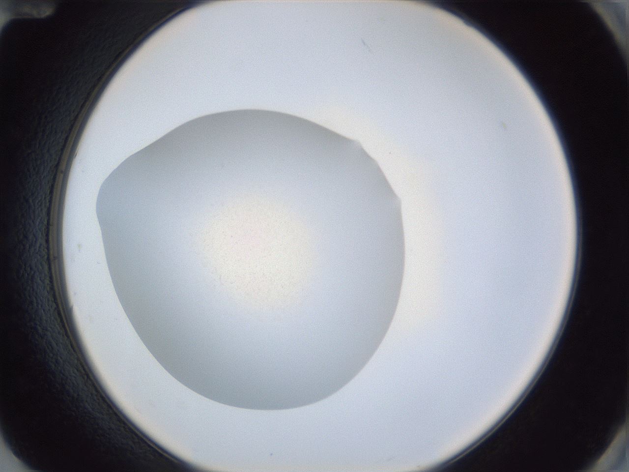 folderID847_plateID1847_batchID7683_wellNum84_profileID1_d2_r126405_ef.jpg