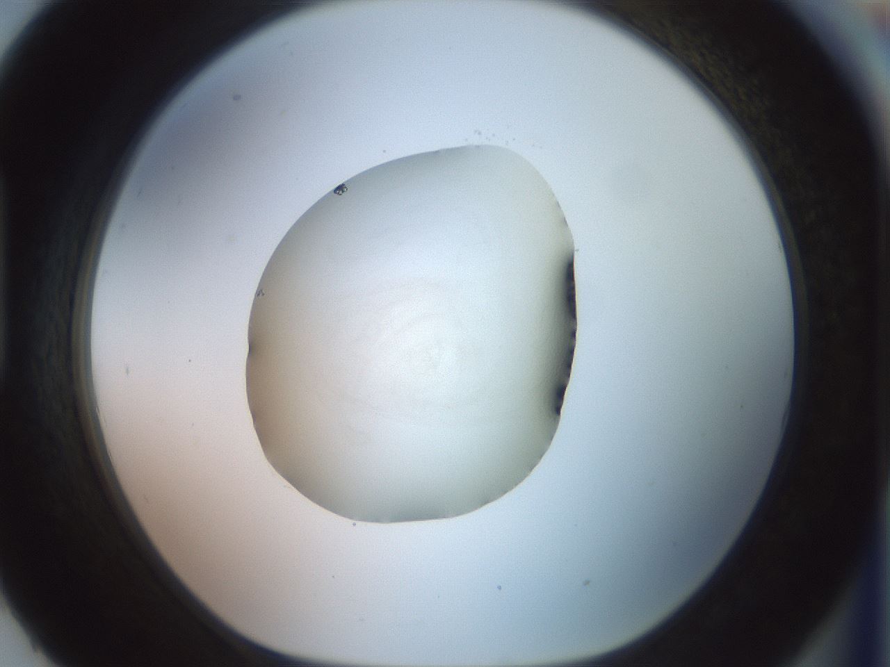 folderID853_plateID1853_batchID7792_wellNum93_profileID1_d1_r124502_ef.jpg