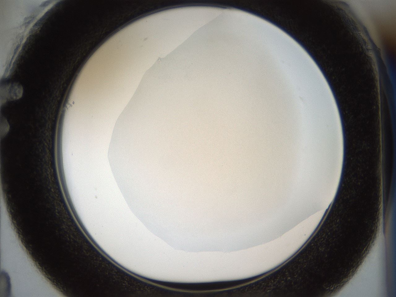 folderID860_plateID860_batchID1002_wellNum61_profileID1_d1_r30471_ef.jpg