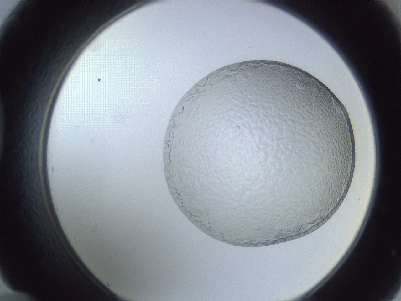 folderID879_plateID879_batchID1036_wellNum48_profileID1_d1_r31597_ef.jpg
