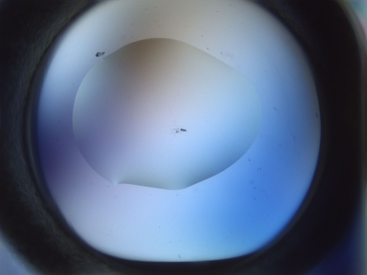 folderID922_plateID1922_batchID8272_wellNum80_profileID1_d1_r128085_ef.jpg