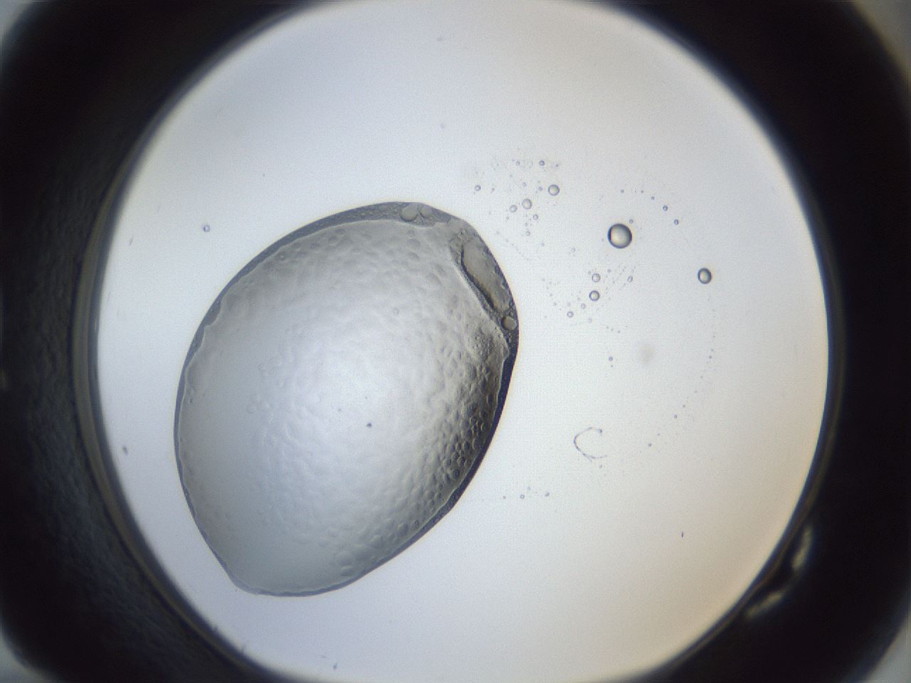 folderID925_plateID925_batchID1213_wellNum82_profileID1_d1_r33645_ef.jpg