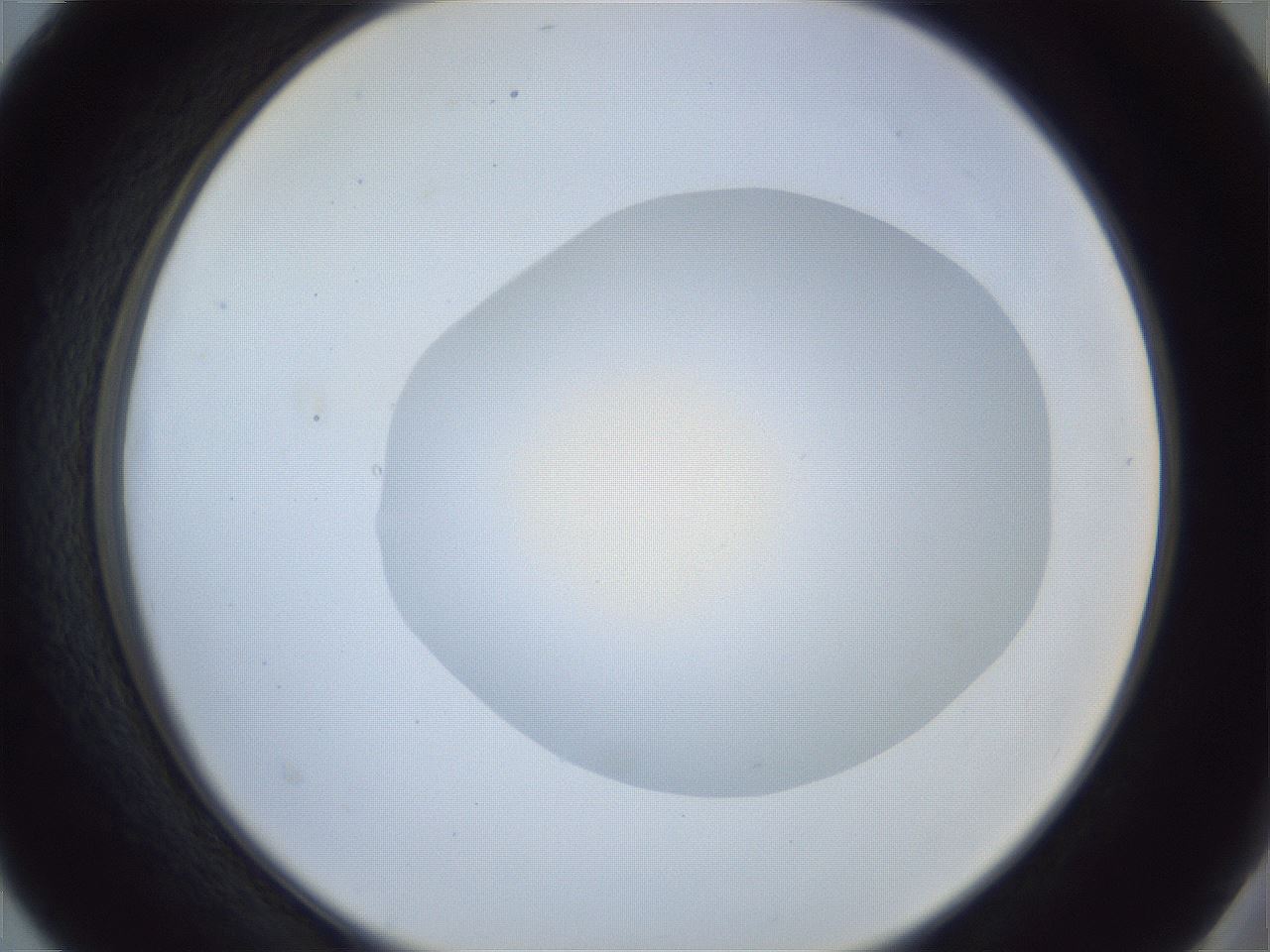 folderID925_plateID925_batchID1265_wellNum40_profileID1_d2_r33562_ef.jpg