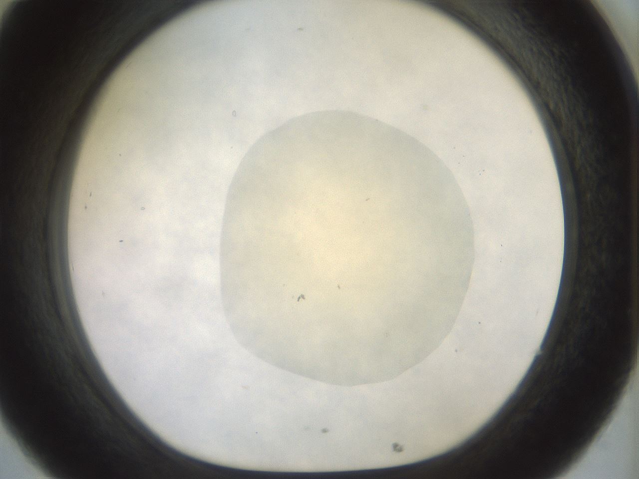 folderID932_plateID1932_batchID8218_wellNum32_profileID1_d1_r128944_ef.jpg