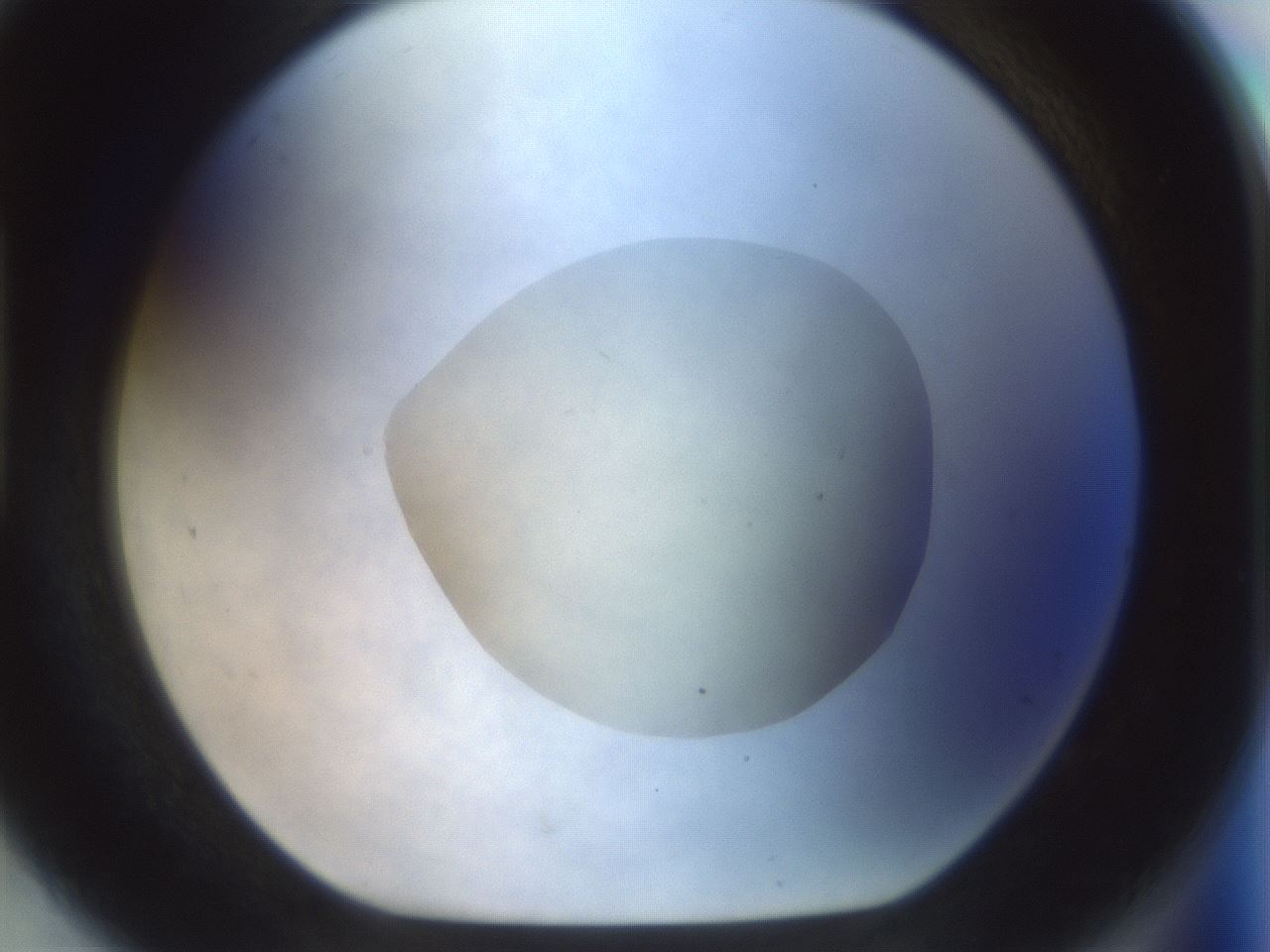 folderID932_plateID1932_batchID8218_wellNum92_profileID1_d1_r129004_ef.jpg