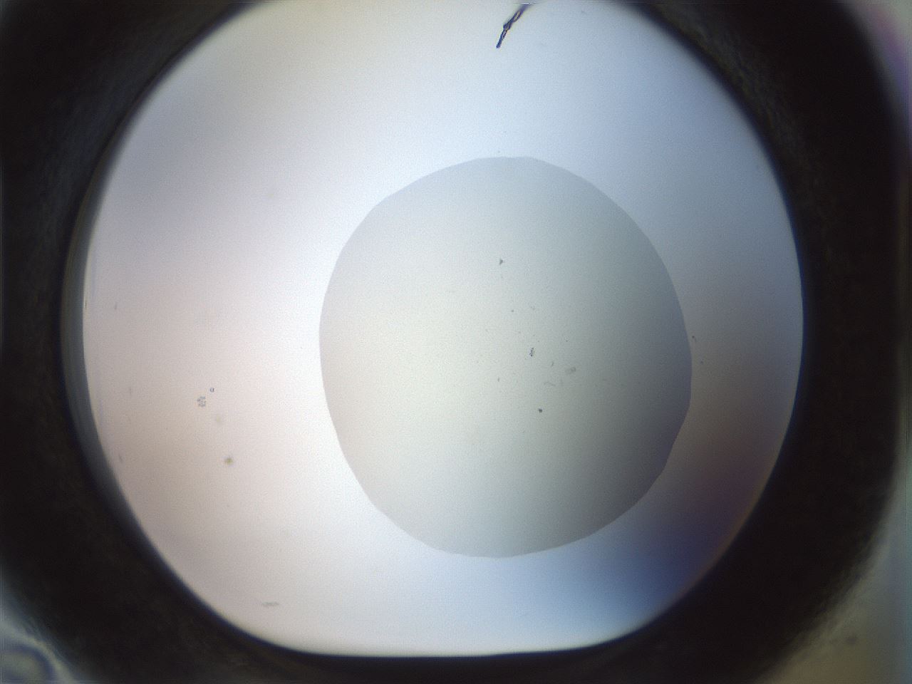 folderID932_plateID1932_batchID8307_wellNum94_profileID1_d1_r129006_ef.jpg