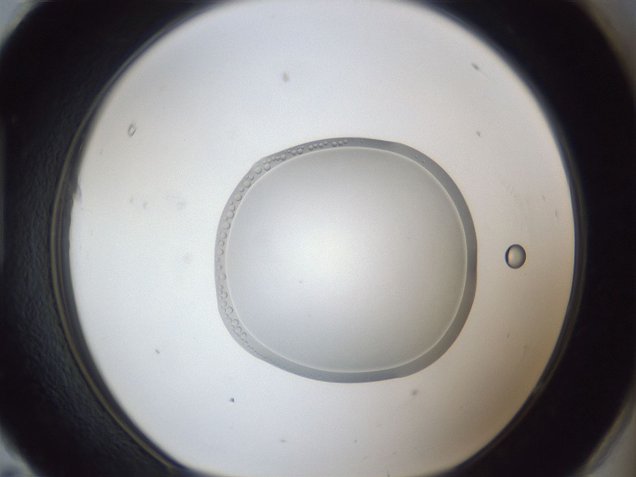 folderID936_plateID936_batchID1544_wellNum95_profileID1_d1_r35039_ef.jpg