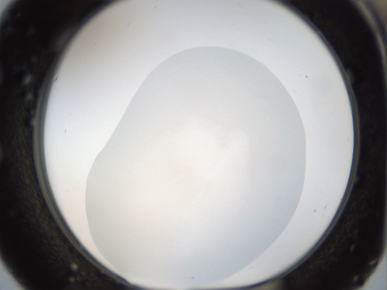 folderID957_plateID957_batchID1360_wellNum51_profileID1_d1_r36487_ef.jpg