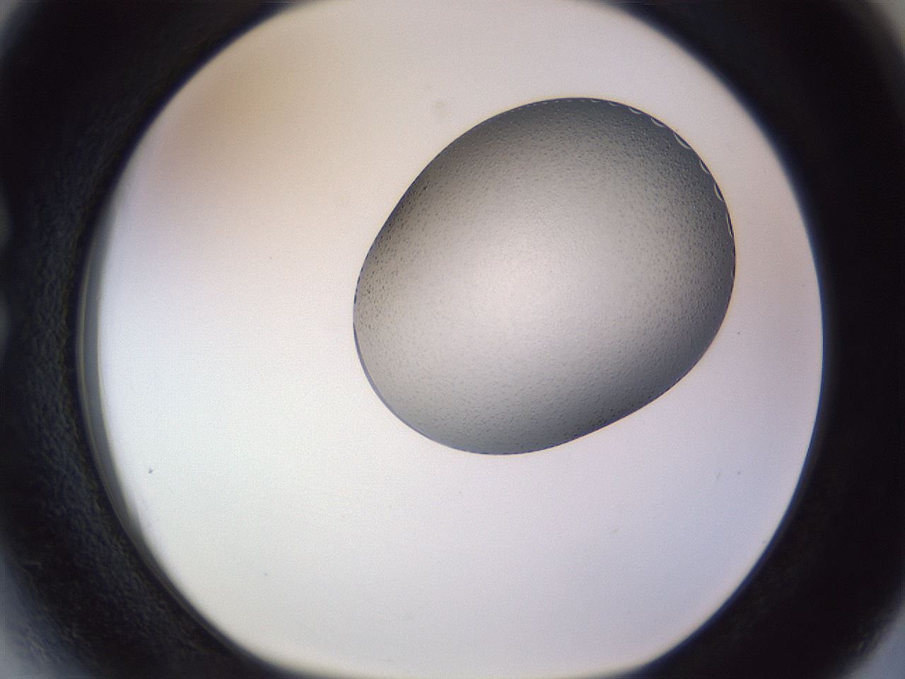 folderID958_plateID1958_batchID8614_wellNum27_profileID1_d1_r133770_ef.jpg