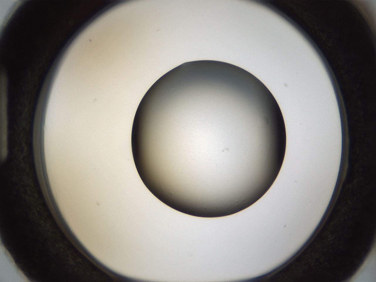 folderID960_plateID960_batchID1395_wellNum87_profileID1_d1_r37250_ef.jpg