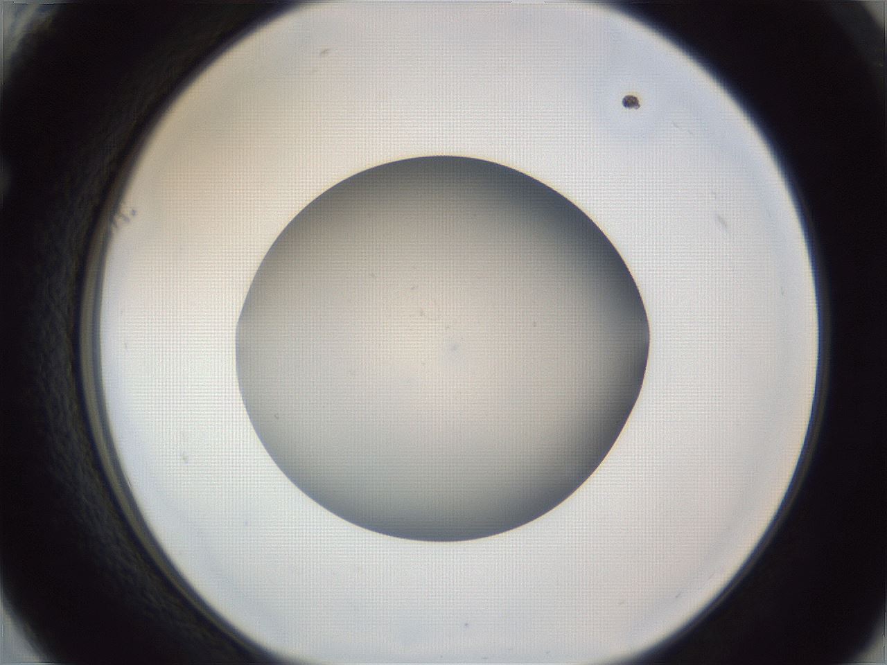 folderID965_plateID965_batchID1487_wellNum61_profileID1_d1_r37626_ef.jpg