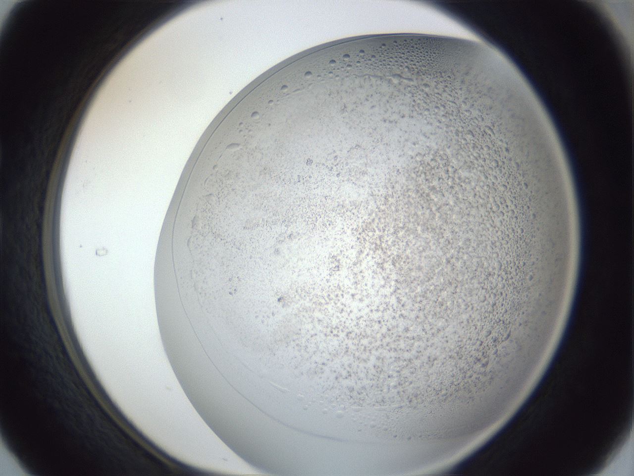 folderID966_plateID966_batchID1372_wellNum29_profileID1_d1_r37690_ef.jpg